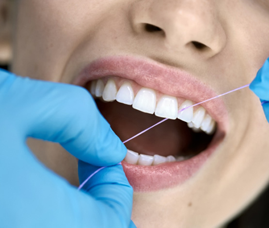 Dental hygienist flossing patient's teeth