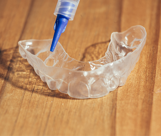 Applicator placing bleaching gel in a clear teeth whitening tray