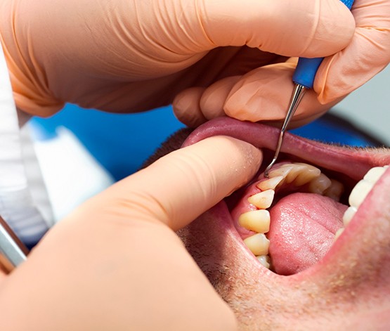Dentist treating patient with gum disease