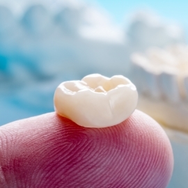 Close up of a dental crown resting on a finger