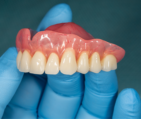 Dentist holding a full upper denture