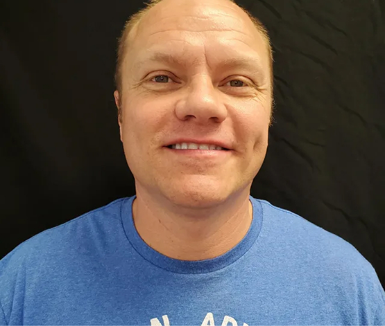 Man smiling with slightly discolored teeth