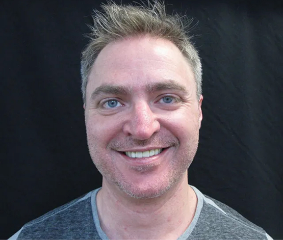Man smiling with slightly yellowed teeth