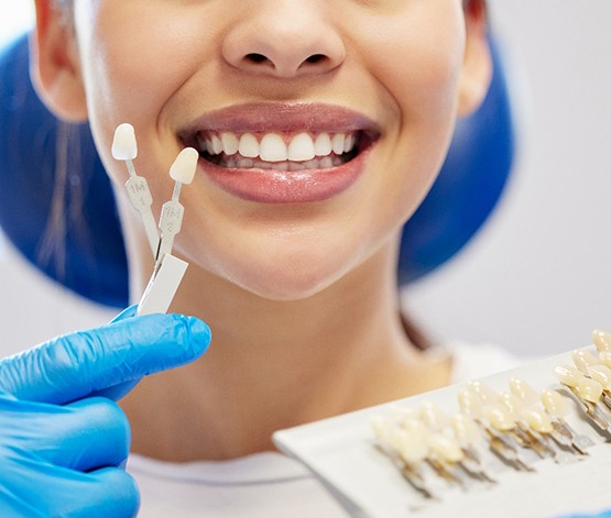 Nose-to-shoulder view of woman in dental chair with shade guides held to her smile