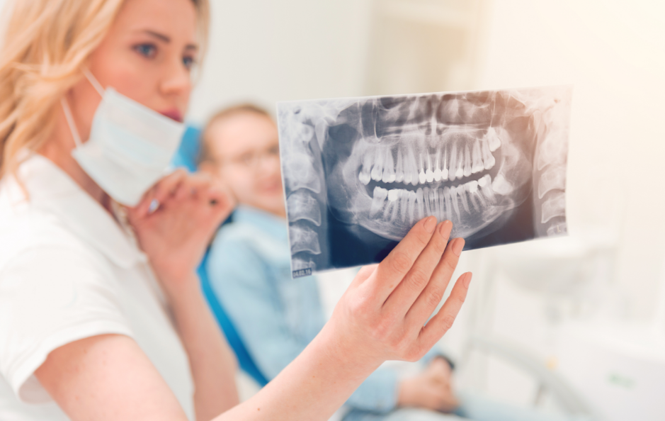 Dentist holding x-ray of wisdom teeth