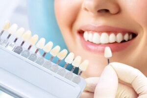 Veneers being held up to smiling patient. 